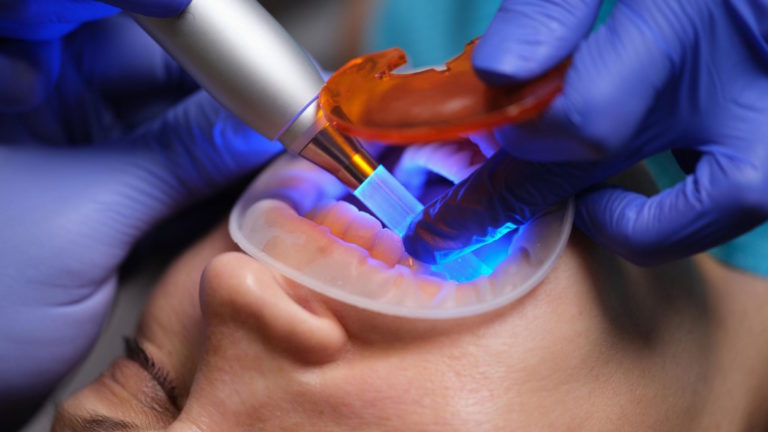Odkryj tajniki nowoczesnej stomatologii: jak dzisiaj leczymy zęby?